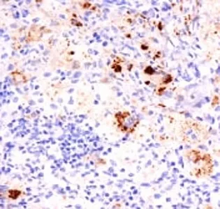 TNF alpha Antibody Cocktail - image 1