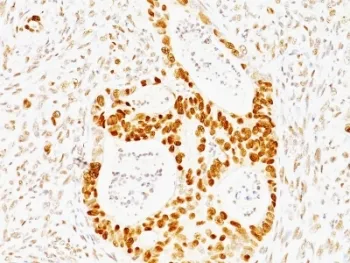 p53 Antibody / TP53 - image 1