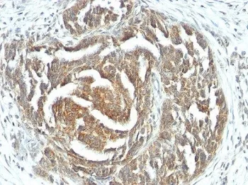VEGFA Antibody / Vascular Endothelial Growth Factor A - image 1