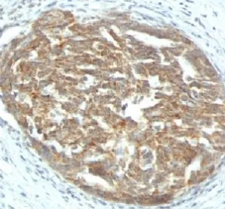 VEGFA Antibody / Vascular Endothelial Growth Factor A - image 1