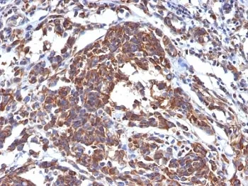 Vimentin Antibody - image 1
