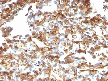 Vimentin Antibody - image 1