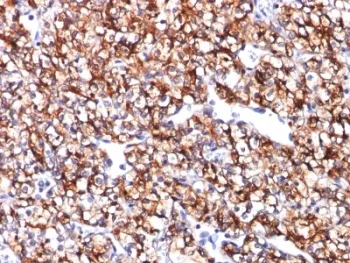 CA9 Antibody / Carbonic Anhydrase IX - image 1