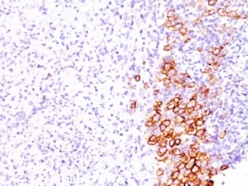 CD30 Antibody - image 1
