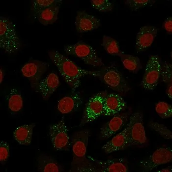 MVP Antibody / Major Vault Protein - image 1