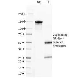 Progesterone Antibody - image 1