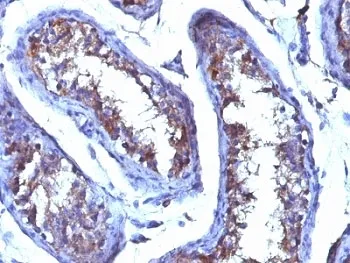 Testosterone Antibody - image 1