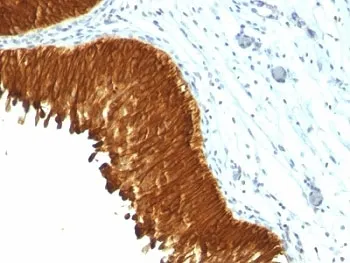 Multi Cytokeratin Antibody - image 1