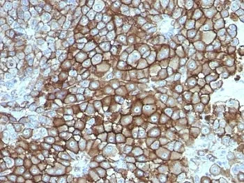 Melanoma Associated Antigen KBA.62 Antibody - image 1