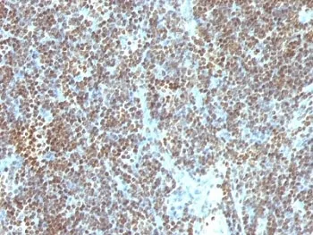 dsDNA Antibody / Double Stranded DNA - image 1