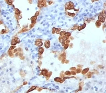 Cytokeratin 8/18 Antibody Cocktail - image 1