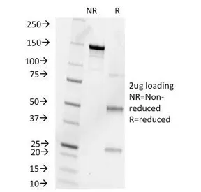 Progesterone Antibody - image 1