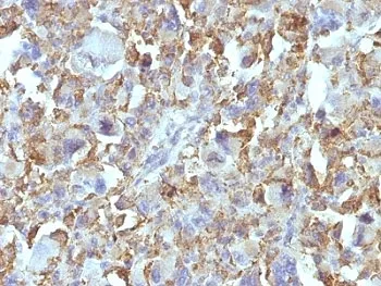 Macrophage / Histiocytoma Marker Antibody - image 1