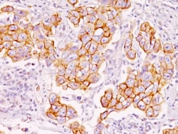 Phosphotyrosine Antibody / P-Tyr - image 1