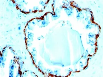 Basic Cytokeratin Antibody - image 1