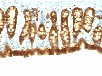 EpCAM Antibody - image 1