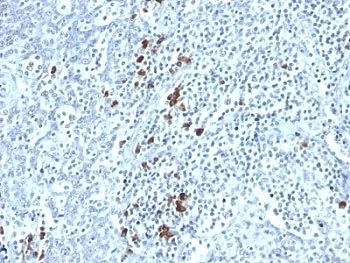 Kappa Light Chain Antibody - image 1
