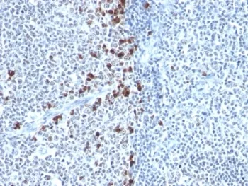 Kappa Light Chain Antibody - image 1