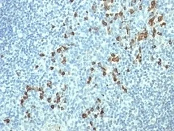 Lambda Light Chain Antibody / Lambda Antibody - image 1