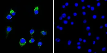 Lambda Light Chain Antibody / Lambda Antibody - image 1