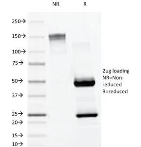 Lambda Light Chain Antibody / Lambda Antibody - image 1