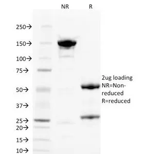PLGF Antibody / PGF / Placenta Growth Factor - image 1