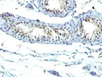 Prolactin Receptor Antibody Cocktail - image 1