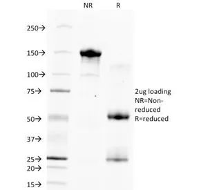 Hepatocyte Specific Antigen Antibody - image 1