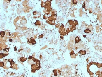 POMC Antibody / ACTH / N-Terminal - image 1