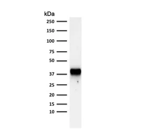 AMACR / p504S Antibody (Prostate Cancer Marker) - image 1