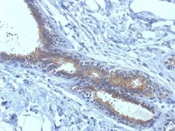 BRCA1 Antibody (Breast Marker) - image 1