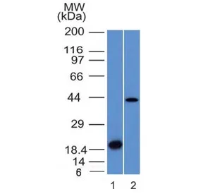 Aurora B Antibody / AURKB - image 1