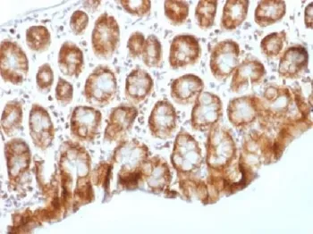 Beta Catenin Antibody - image 1