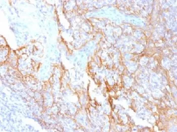 Beta Catenin Antibody - image 1