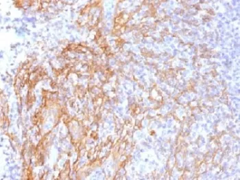 Beta Catenin Antibody - image 1