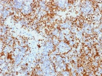 Integrin beta 3 Antibody / ITGB3 / CD61 - image 1