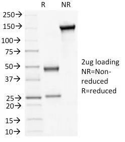 Desmoglein 3 Antibody / DSG3 - image 1