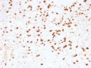 Lambda Light Chain Antibody / Lambda Antibody - image 1
