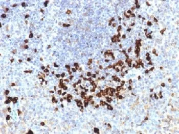 Lambda Light Chain Antibody / Lambda Antibody - image 1