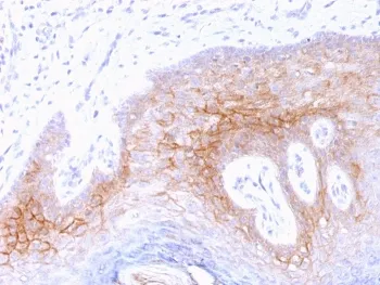 Desmocollin 2/3 Antibody - image 1