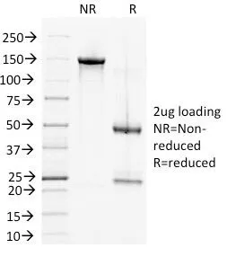 Desmoglein 2 Antibody / DSG2 - image 1