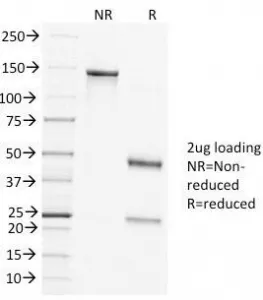Clathrin Heavy Chain Antibody - image 1