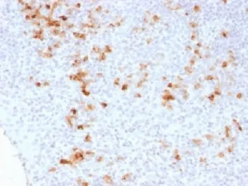 Kappa Light Chain Antibody - image 1