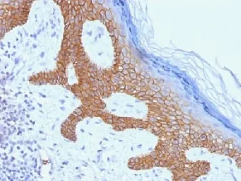 Desmoglein 3 Antibody / DSG3 - image 1