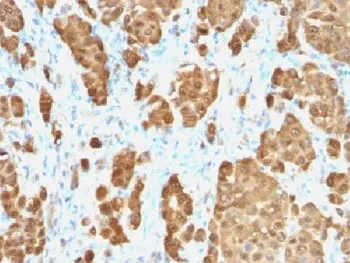 S100B Recombinant Antibody - image 1