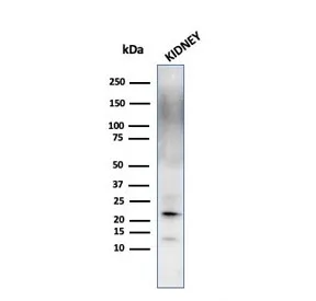 FTL Antibody / Ferritin light chain - image 1