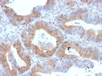 hCG Receptor / LH Receptor Antibody - image 1
