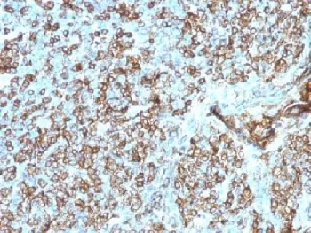 HLA-DP + HLA-DQ + HLA-DR Antibody (MHC II) - image 1