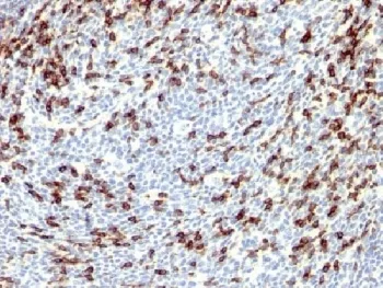 PDCD1 Antibody / PD-1 / PD1 - image 1