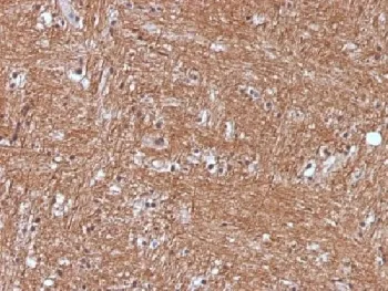 NSE Antibody / Neuron Specific Enolase - image 1